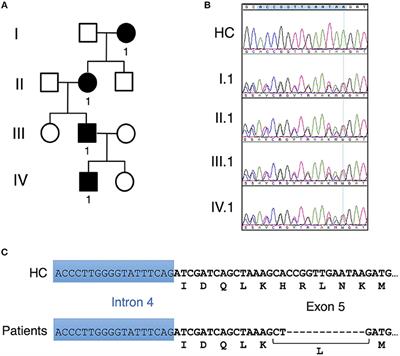 A Unique Heterozygous CARD11 Mutation Combines Pathogenic Features of Both Gain- and Loss-of-Function Patients in a Four-Generation Family